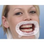 Quel écarteur de joues est le mieux pour vous ?
